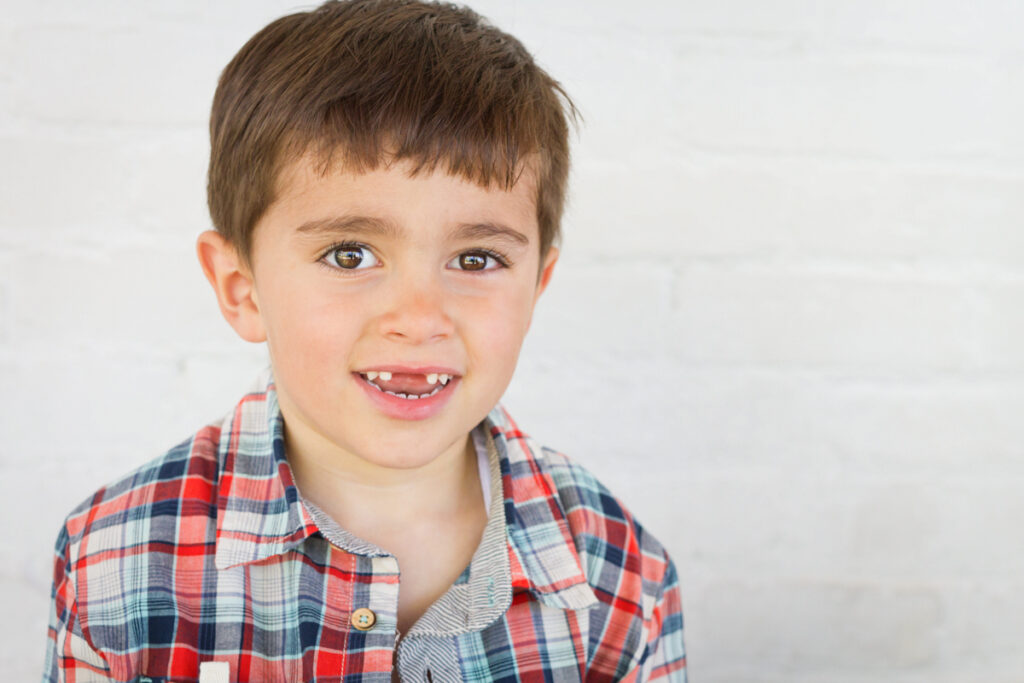 palm harbor photographer close up of boy missing his two front teeth